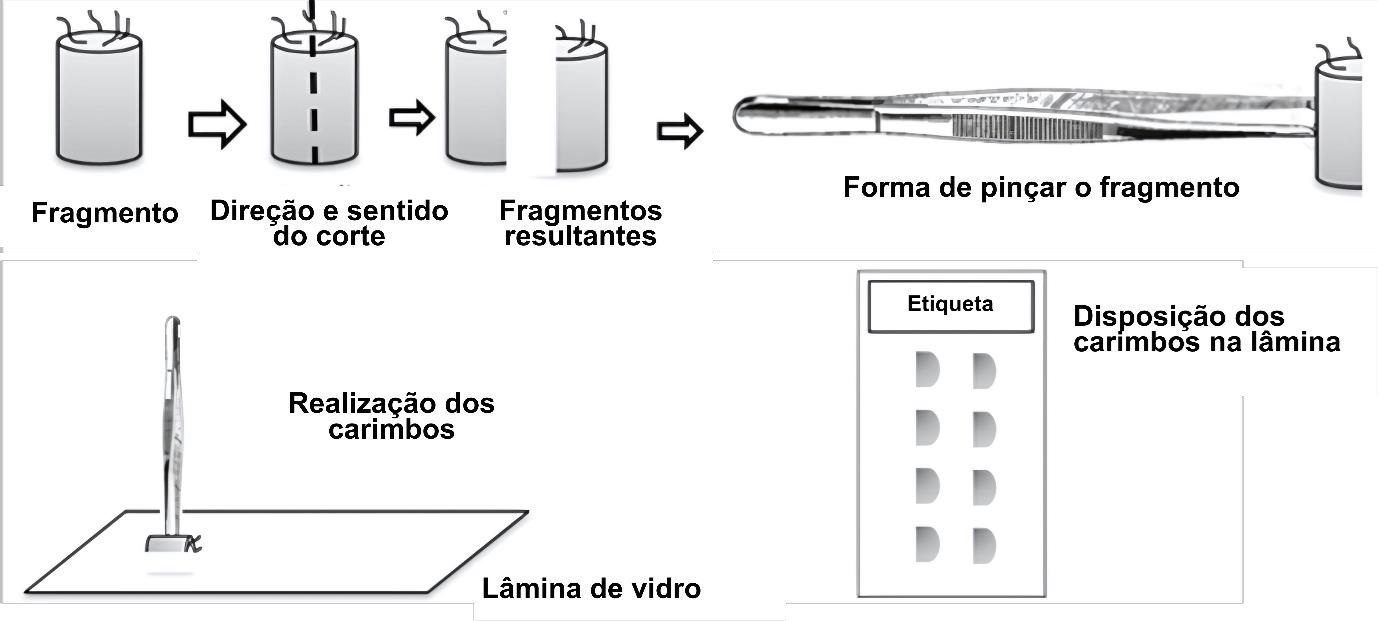 Esquema ilustrativo do procedimento de “imprinting” (carimbo histológico). Mostra, da esquerda para a direita e de cima para baixo: fragmento cilíndrico de tecido; direção e sentido do corte vertical do fragmento; fragmentos resultantes após o corte; forma correta de pinçar o fragmento com uma pinça; execução do carimbo pressionando o fragmento na lâmina de vidro; e disposição final dos carimbos na lâmina, organizados em duas colunas de três carimbos semicirculares, com etiqueta na parte superior da lâmina. Fonte: Figura 22. Procedimento de “imprinting”. Este material é disponibilizado como recurso educacional aberto para fins acadêmicos e científicos. Fonte: os autores.​